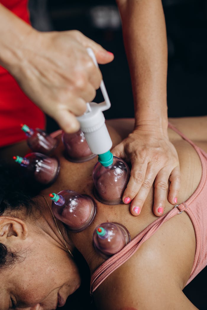 Close-up of cupping therapy on a womans back, focusing on muscle recovery and relaxation.